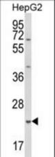 Western blot of GSTA4 Antibody in HepG2 cell line lysates (35 ug/lane). GSTA4 (arrow) was detected using the purified antibody.