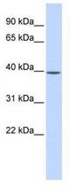Western analysis of fetal liver lysate.