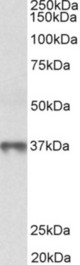MAT2B antibody (0.3 ug/ml) staining of Human Thymus lysate (35 ug protein in RIPA buffer). Primary incubation was 1 hour. Detected by chemiluminescence.