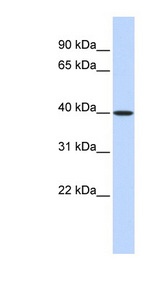MAT2B antibody LS-C111720 Western blot of Fetal Lung lysate.