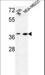 Western blot of MAT2B Antibody in293,MDA-MB231 cell line lysates (35 ug/lane). MAT2B (arrow) was detected using the purified antibody.