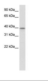 Transfected 293T Cell Lysate