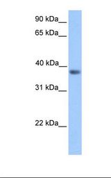 Transfected 293T cell lysate. Antibody concentration: 1.0 ug/ml. Gel concentration: 12%.