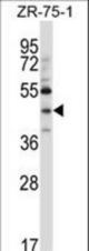 NEUROD6 Antibody (N-term ) western blot of ZR-75-1 cell line lysates (35 ug/lane). The NEUROD6 antibody detected the NEUROD6 protein (arrow).