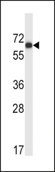 MATK Antibody (M1) western blot of HL-60 cell line lysates (35 ug/lane). The MATK antibody detected the MATK protein (arrow).