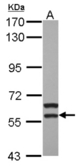 Sample (30 ug of whole cell lysate) A: HepG2 7.5% SDS PAGE MATK antibody diluted at 1:1000