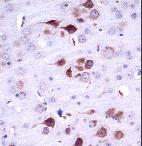 Mouse Matk Antibody immunohistochemistry of formalin-fixed and paraffin-embedded mouse brain tissue followed by peroxidase-conjugated secondary antibody and DAB staining.