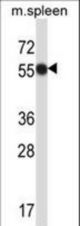 Mouse Matk Antibody western blot of mouse spleen tissue lysates (35 ug/lane). The Matk antibody detected the Matk protein (arrow).