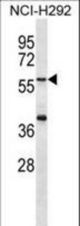 MATN1 Antibody western blot of NCI-H292 cell line lysates (35 ug/lane). The MATN1 antibody detected the MATN1 protein (arrow).