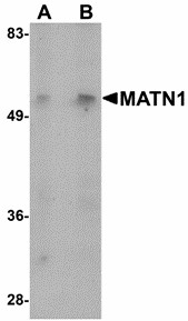 Western blot of MATN1 in mouse liver tissue lysate with MATN1 antibody at (A) 1 and (B) 2 ug/ml.
