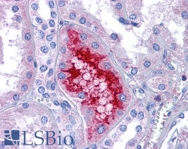 Anti-MATN1 / Matrilin 1 antibody IHC of human kidney. Immunohistochemistry of formalin-fixed, paraffin-embedded tissue after heat-induced antigen retrieval. Antibody LS-B5000 concentration 5 ug/ml.