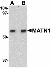 Western blot of MATN1 in rat liver tissue lysate with MATN1 antibody at (A) 1 and (B) 2 ug/ml.