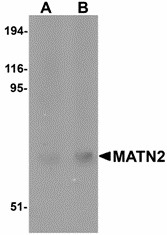 Western blot of MATN2 in human liver tissue lysate with MATN2 antibody at (A) 1 and (B) 2 ug/ml.