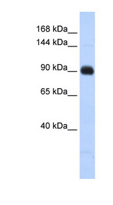 MATN2 / Matrilin 2 antibody LS-C102725 Western blot of Fetal Lung lysate.