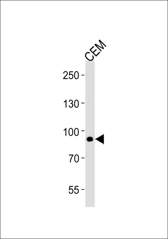 MATN2 Antibody western blot of CEM cell line lysates (35 ug/lane). The MATN2 antibody detected the MATN2 protein (arrow).