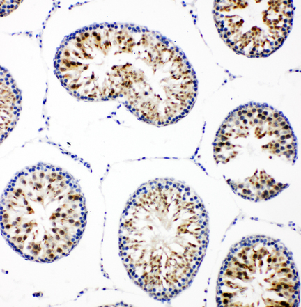 MATN2 / Matrilin 2 antibody. IHC(P): Rat Testis Tissue.
