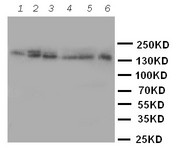 WB of MATN2 / Matrilin 2 antibody. Lane 1: Rat Brain Tissue Lysate. Lane 2: Rat Testis Tissue Lysate. Lane 3: Rat Ovary Tissue Lysate. Lane 4: A549 Cell Lystae. Lane 5: SKOV Cell Lysate. Lane 6: SMMC Cell Lysate.