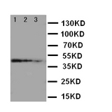 WB of MATN2 / Matrilin 2 antibody. Recombinant Protein Detection Source:. E.coli derived -recombinant human MATN2, 35.8KD. (162aa tag+Q803-R956). Lane 1: Recombinant Human MATN2 Protein 10ng. Lane 2: Recombinant Human MATN2 Protein 5ng. Lane 3: Recombinant Human MATN2 Protein 2.5ng.