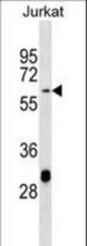 MATN3 Antibody western blot of Jurkat cell line lysates (35 ug/lane). The MATN3 antibody detected the MATN3 protein (arrow).