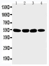 WB of MATN3 / Matrilin 3 antibody. Lane 1: 293T Cell Lysate. Lane 2: COLO320 Cell Lysate. Lane 3: HELA Cell Lysate. Lane 4: A549 Cell Lysate.