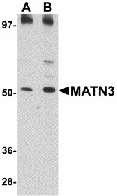 Western blot of MATN3 in 3T3 cell lysate with MATN3 antibody at (A) 1 and (B) 2 ug/ml. Below: Immunocytochemistry of MATN3 in 3T3 cells with MATN3 antibody at 5 ug/ml.