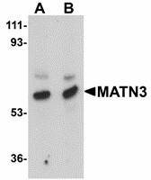 Western blot of MATN3 in rat thymus tissue lysate with MATN3 antibody at (A) 1 and (B) 2 ug/ml. Below: Immunocytochemistry of MATN3 in 3T3 cells tissue with MATN3 antibody at 2.5 ug/ml.