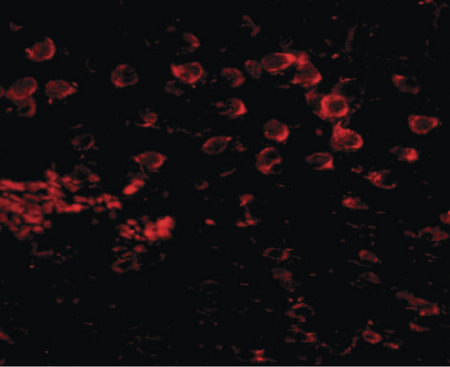 Immunofluorescence of MATN4 in mouse brain tissue with MATN4 antibody at 20 ug/ml.