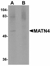 Western blot of MATN4 in rat brain tissue lysate with MATN4 antibody at 1 ug/ml in (A) the absence and (B) the presence of blocking peptide. Below: Immunohistochemistry of MATN4 in mouse brain tissue with MATN4 antibody at 2.5 ug/ml.