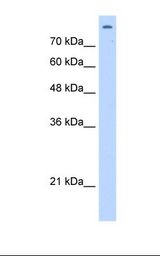 HepG2 cell lysate. Antibody concentration: 2.5 ug/ml. Gel concentration: 12%.