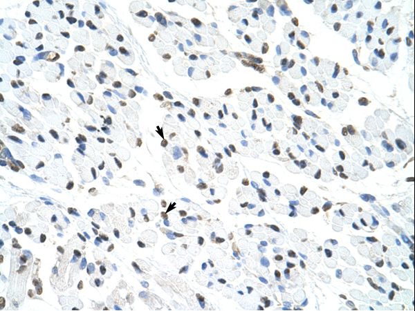 MATR3 / Matrin 3 antibody LS-C31742 was used in IHC to stain formalin-fixed, paraffin-embedded human muscle.