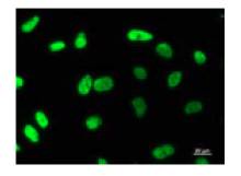 Immunostaining analysis in HeLa cells. HeLa cells were fixed with 4% paraformaldehyde and permeabilized with 0.1% Triton X-100 in PBS.