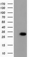 HEK293T cells were transfected with the pCMV6-ENTRY control (Left lane) or pCMV6-ENTRY PBLD (Right lane) cDNA for 48 hrs and lysed. Equivalent amounts of cell lysates (5 ug per lane) were separated by SDS-PAGE and immunoblotted with anti-PBLD.
