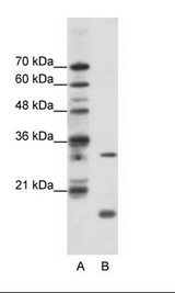 A: Marker, B: HepG2 Cell Lysate