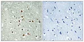 IHC of paraffin-embedded human brain tissue, using MAX Antibody. The sample on the right was incubated with synthetic peptide.