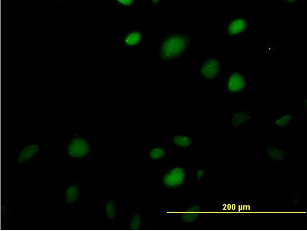 Immunofluorescence of monoclonal antibody to MAZ on HeLa cell. [antibody concentration 35 ug/ml]