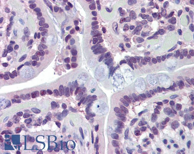 Anti-MAZ antibody IHC of human small intestine. Immunohistochemistry of formalin-fixed, paraffin-embedded tissue after heat-induced antigen retrieval. Antibody LS-B3519 concentration 10 ug/ml.