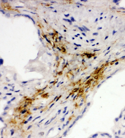 MADCAM1 / MAdCAM-1 antibody. IHC(F): Human Placenta Tissue.