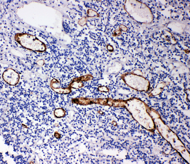 MADCAM1 / MAdCAM-1 antibody. IHC(P): Human Appendicitis Tissue.