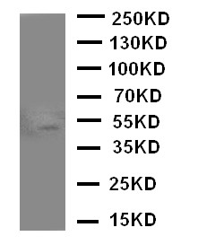 WB of MADCAM1 / MAdCAM-1 antibody. WB: HELA Cell Lysate.