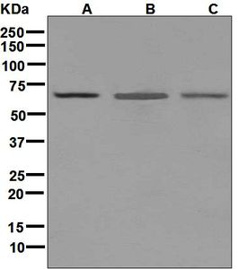Western blot analysis on (A) HeLa, (B) HUVEC, and (C) ECV-304 cell lysates using anti-MADCAM1 antibody.