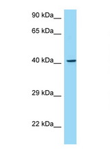 MADCAM1 / MAdCAM-1 antibody LS-C146484 Western blot of 435S Cell lysate. Antibody concentration 1 ug/ml.