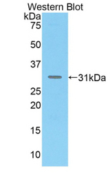 Western blot of recombinant MADCAM1 / MAdCAM-1.