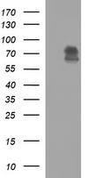 HEK293T cells were transfected with the pCMV6-ENTRY control (Left lane) or pCMV6-ENTRY MADCAM1 (Right lane) cDNA for 48 hrs and lysed. Equivalent amounts of cell lysates (5 ug per lane) were separated by SDS-PAGE and immunoblotted with anti-MADCAM1.