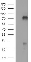 HEK293T cells were transfected with the pCMV6-ENTRY control (Left lane) or pCMV6-ENTRY MADCAM1 (Right lane) cDNA for 48 hrs and lysed. Equivalent amounts of cell lysates (5 ug per lane) were separated by SDS-PAGE and immunoblotted with anti-MADCAM1.