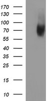 HEK293T cells were transfected with the pCMV6-ENTRY control (Left lane) or pCMV6-ENTRY MADCAM1 (Right lane) cDNA for 48 hrs and lysed. Equivalent amounts of cell lysates (5 ug per lane) were separated by SDS-PAGE and immunoblotted with anti-MADCAM1.