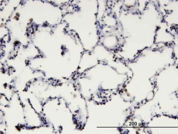 Immunoperoxidase of monoclonal antibody to MBD1 on formalin-fixed paraffin-embedded human lung. [antibody concentration 3 ug/ml]