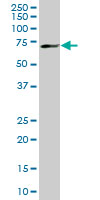 MBD1 monoclonal antibody (M02), clone 2C7. Western blot of MBD1 expression in IMR-32.