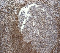 IHC of paraffin-embedded human tonsils using anti-MBD1 antibody.
