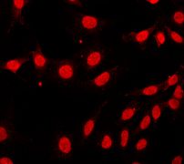 Immunofluorescent staining of MCF7 cells using anti-MBD1 antibody.