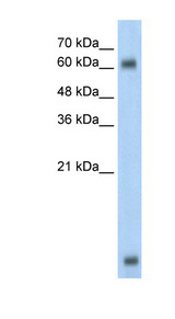 MBD1 antibody LS-B1545 Western blot of HepG2 cell lysate.